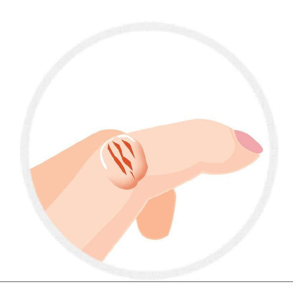 小林製藥 Sakamukea 液體繃帶手指疤痕護理 10g